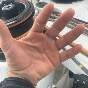 A sailor's hand after 7 weeks of racing